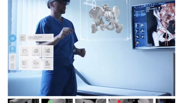 Νέα εποχή για τις αρθροπλαστικές γόνατος και ισχίου